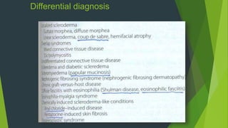 Differential diagnosis
 