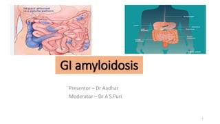GI amyloidosis
Presentor – Dr Aadhar
Moderator – Dr A S Puri
1
 