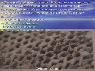 Смазанный слойСмазанный слой
Смазанный слой – это структура, образующаяся на поверхностиСмазанный слой – это структура, образующаяся на поверхности
дентина в результате препарирования. В его состав входятдентина в результате препарирования. В его состав входят
обломки дентинных трубочек, коллагеновых волокон, клеткиобломки дентинных трубочек, коллагеновых волокон, клетки
микрофлоры полости рта, минеральные компоненты эмали имикрофлоры полости рта, минеральные компоненты эмали и
дентина.дентина.
Топография смазанного слояТопография смазанного слоя::
----собственно смазаый слойсобственно смазаый слой;;
--пробки смазанного слоя.--пробки смазанного слоя.
Толщина смазанного слоя 5-15 мкм.Толщина смазанного слоя 5-15 мкм.
 