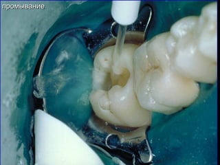 промываниепромывание
 