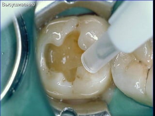 ВысушиваниеВысушивание
 