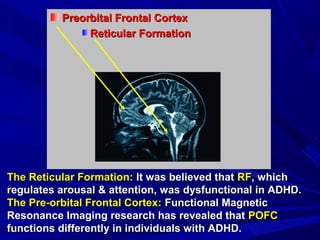 Adhd | PPT