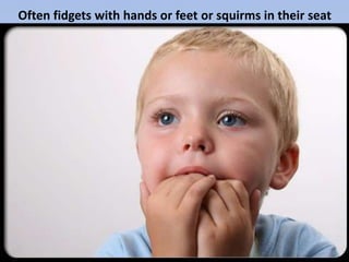 Often fidgets with hands or feet or squirms in their seat
 