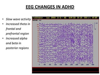 EEG CHANGES IN ADHD
• Slow wave activity
• Increased theta in
frontal and
prefrontal region
• Increased alpha
and beta in
posterior regions
 