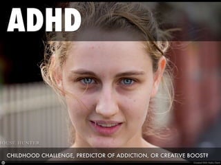  Adhd   childhood challenge predictor of addiction or creative boost