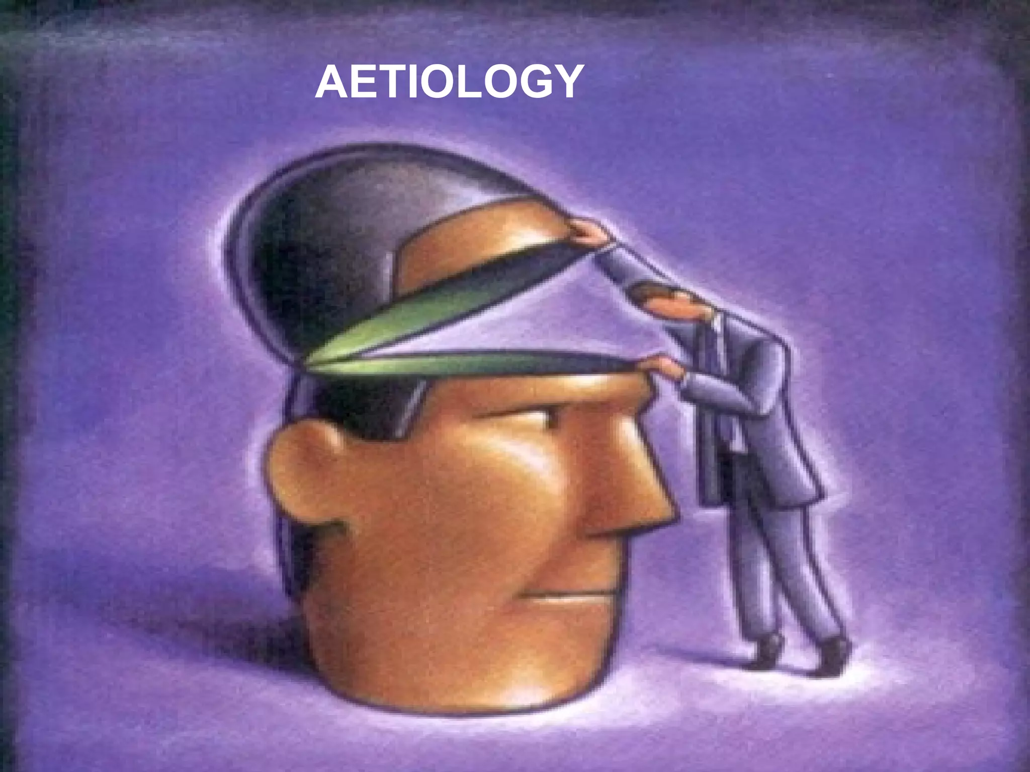AETIOLOGY
 