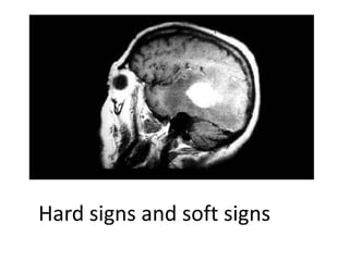 Hard signs and soft signs
 