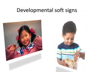 Developmental soft signs
 