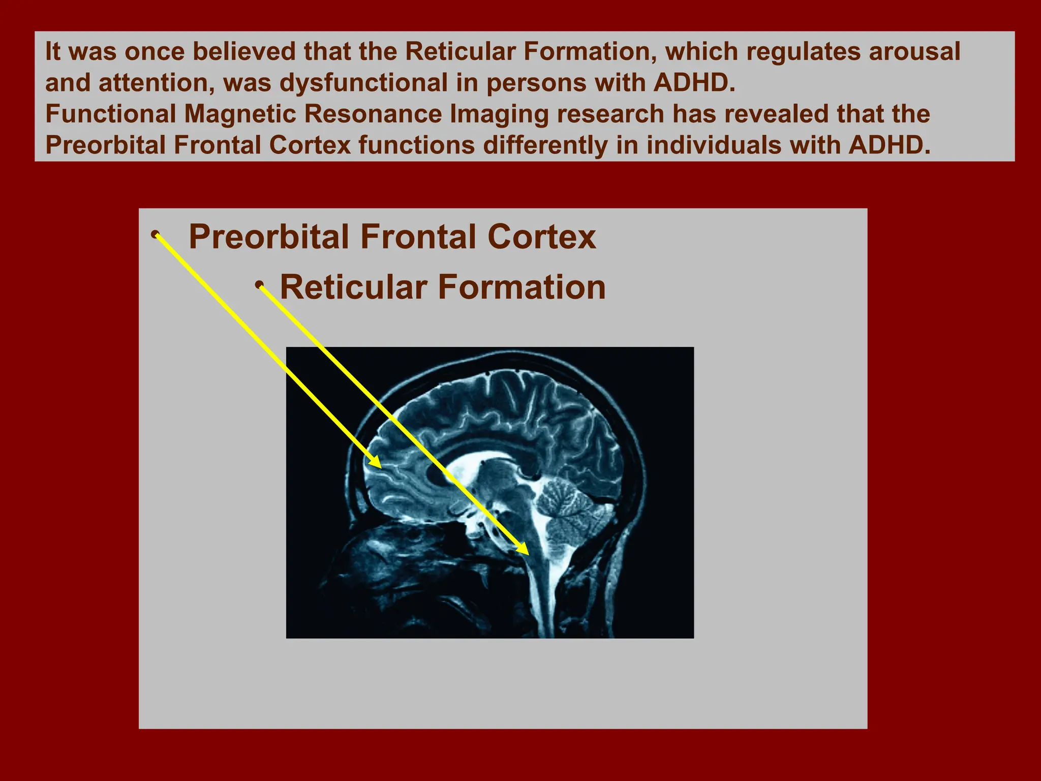 Attention Deficit HyperactivityDisorder Powerpoint | PPT