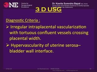 3 D USG
DiagnosDc	
  Criteria	
  :	
  
Ø 	
  Irregular	
  intraplacental	
  vascularizaDon	
  
with	
  tortuous	
  conﬂuent	
  vessels	
  crossing	
  
placental	
  width.	
  
Ø 	
  Hypervascularity	
  of	
  uterine	
  serosa–
bladder	
  wall	
  interface.	
  
	
  
3-­‐Feb-­‐19	
   Dr	
  Shashwat	
  Jani.	
  	
  	
  	
  99099	
  44160.	
   18	
  
 