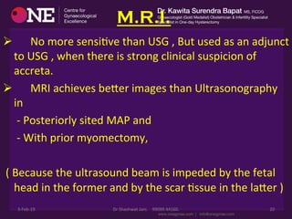 M.R.I.
Ø 	
  	
  	
  	
  	
  	
  No	
  more	
  sensiDve	
  than	
  USG	
  ,	
  But	
  used	
  as	
  an	
  adjunct	
  
to	
  USG	
  ,	
  when	
  there	
  is	
  strong	
  clinical	
  suspicion	
  of	
  
accreta.	
  
Ø 	
  	
  	
  	
  	
  	
  MRI	
  achieves	
  becer	
  images	
  than	
  Ultrasonography	
  
in	
  	
  
	
  	
  	
  	
  	
  -­‐	
  Posteriorly	
  sited	
  MAP	
  and	
  	
  
	
  	
  	
  	
  	
  -­‐	
  With	
  prior	
  myomectomy,	
  
	
  
	
  (	
  Because	
  the	
  ultrasound	
  beam	
  is	
  impeded	
  by	
  the	
  fetal	
  
head	
  in	
  the	
  former	
  and	
  by	
  the	
  scar	
  Dssue	
  in	
  the	
  lacer	
  )	
  
3-­‐Feb-­‐19	
   Dr	
  Shashwat	
  Jani.	
  	
  	
  	
  99099	
  44160.	
   20	
  
 