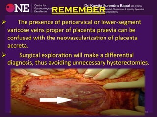 remember
Ø 	
  	
  	
  	
  	
  	
  	
  The	
  presence	
  of	
  pericervical	
  or	
  lower-­‐segment	
  
varicose	
  veins	
  proper	
  of	
  placenta	
  praevia	
  can	
  be	
  
confused	
  with	
  the	
  neovascularizaDon	
  of	
  placenta	
  
accreta.	
  	
  
Ø 	
  	
  	
  	
  	
  	
  	
  	
  Surgical	
  exploraDon	
  will	
  make	
  a	
  diﬀerenDal	
  
diagnosis,	
  thus	
  avoiding	
  unnecessary	
  hysterectomies.	
  
3-­‐Feb-­‐19	
   Dr	
  Shashwat	
  Jani.	
  	
  	
  	
  99099	
  44160.	
   34	
  
 