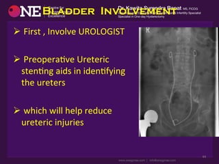 Bladder Involvement
Ø 	
  First	
  ,	
  Involve	
  UROLOGIST	
  
	
  
Ø 	
  PreoperaDve	
  Ureteric	
  	
  
stenDng	
  aids	
  in	
  idenDfying	
  
the	
  ureters	
  
Ø 	
  which	
  will	
  help	
  reduce	
  
ureteric	
  injuries	
  
44	
  
 