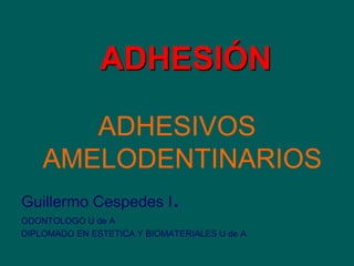 ADHESIÓN
ADHESIVOS
AMELODENTINARIOS
Guillermo Cespedes I.
ODONTOLOGO U de A
DIPLOMADO EN ESTETICA Y BIOMATERIALES U de A
 
