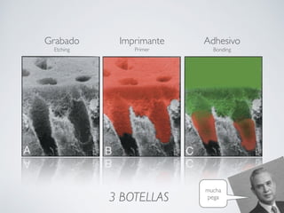 Grabado
Etching
Imprimante
Primer
Adhesivo
Bonding
3 BOTELLAS
mucha
pega
 