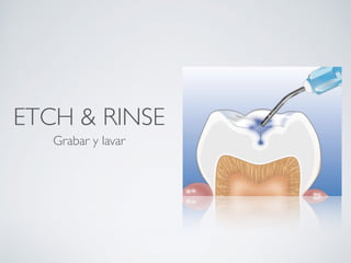 ETCH & RINSE
Grabar y lavar
 