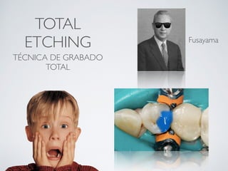 TOTAL
ETCHING
TÉCNICA DE GRABADO
TOTAL
Fusayama
 