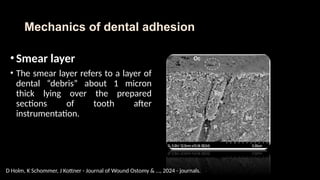 Smearing Adhesion Example Advancements and Mechanisms in Dental Adhesion and Restorative ...