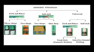 Advancements and Mechanisms in Dental Adhesion and Restorative ...