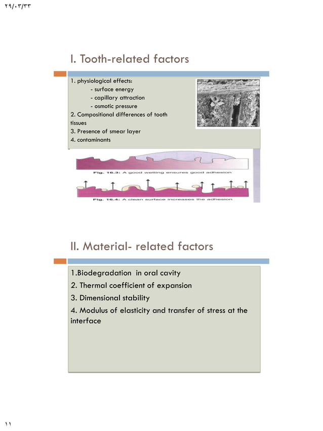 Adhesion in restorative dentistry