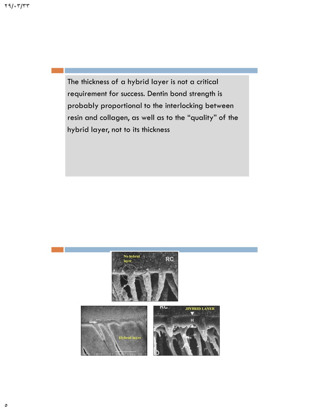 Adhesion in restorative dentistry