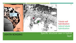 Adhesion & Bonding in Dentistry | PPTX