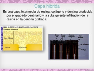 Capa hibrida 
Es una capa intermedia de resina, colágeno y dentina producida
por el grabado dentinario y la subsiguiente infiltración de la
resina en la dentina grabada.
 