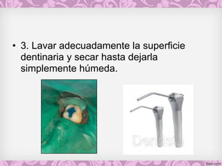 • 3. Lavar adecuadamente la superficie
dentinaria y secar hasta dejarla
simplemente húmeda.
 