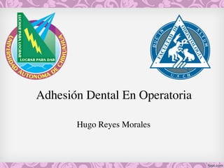 Hugo Reyes Morales
Adhesión Dental En Operatoria
 
