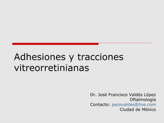 Adhesiones y tracciones
vitreorretinianas
Dr. José Francisco Valdés López
Oftalmología
Contacto: pacovaldes@live.com
Ciudad de México
 