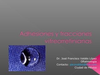 Dr. José Francisco Valdés López
Oftalmología
Contacto: pacovaldes@live.com
Ciudad de México
 