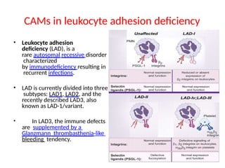 CAMs in leukocyte adhesion deficiency
• Leukocyte adhesion
deficiency (LAD), is a
rare autosomal recessive disorder
characterized
by immunodeficiency resulting in
recurrent infections.
• LAD is currently divided into three
subtypes: LAD1, LAD2, and the
recently described LAD3, also
known as LAD-1/variant.
• In LAD3, the immune defects
are supplemented by a
Glanzmann thrombasthenia-like
bleeding tendency.
 