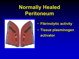 Normally Healed
Peritoneum
• Fibrinolytic activity
• Tissue plasminogen
activator
 