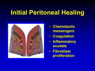 Initial Peritoneal Healing
• Chemotactic
messengers
• Coagulation
• Inflammatory
exudate
• Fibroblast
proliferation
 