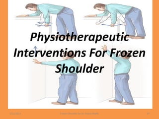 Physiotherapeutic
Interventions For Frozen
Shoulder
1/13/2021 Frozen Shoulder by Dr. Shazia Khalfe 37
 