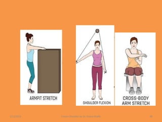 1/13/2021 Frozen Shoulder by Dr. Shazia Khalfe 48
 