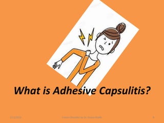 What is Adhesive Capsulitis?
1/13/2021 Frozen Shoulder by Dr. Shazia Khalfe 8
 