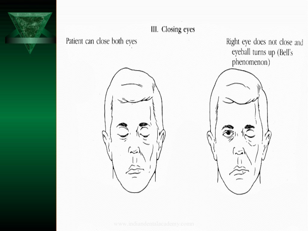 Adhesives in maxillofacial prosthesis /orthodontics courses in india
