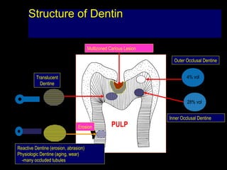 Translucent Dentin Adhesives | PPT