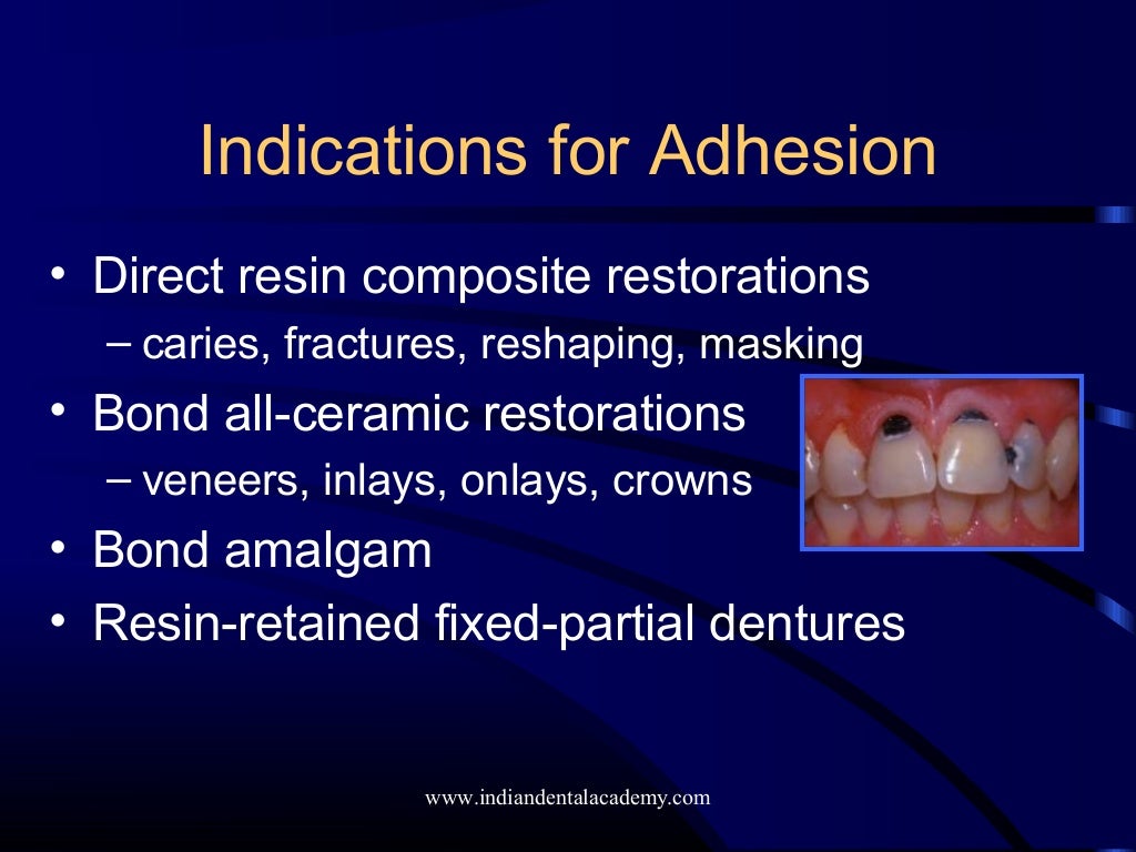 Adhesives / dental implant courses
