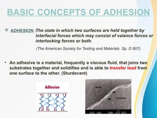 BASIC CONCEPTS OF ADHESION
The state in which two surfaces are held together by
interfacial forces which may consist of valance forces or
interlocking forces or both.
 ADHESION :
(The American Society for Testing and Materials Sp. D 907)
• An adhesive is a material, frequently a viscous fluid, that joins two
substrates together and solidifies and is able to transfer load from
one surface to the other. (Sturdevant)
 