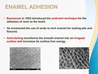 ENAMEL ADHESION
• Buonocore in 1955 introduced the acid-etch technique for the
adhesion of resin to the tooth.
• He envisioned the use of acids to etch enamel for sealing pits and
fissures.
• Acid etching transforms the smooth enamel into an irregular
surface and increases its surface free energy.
 