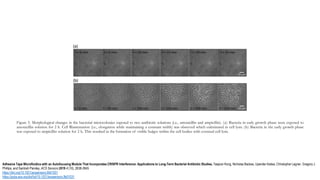 Figure 5. Morphological changes in the bacterial microcolonies exposed to two antibiotic solutions (i.e., amoxicillin and ampicillin). (a) Bacteria in early growth phase were exposed to
amoxicillin solution for 2 h. Cell ﬁlamentation (i.e., elongation while maintaining a constant width) was observed which culminated in cell lysis. (b) Bacteria in the early growth phase
was exposed to ampicillin solution for 2 h. This resulted in the formation of visible bulges within the cell bodies with eventual cell lysis.
Adhesive Tape Microfluidics with an Autofocusing Module That Incorporates CRISPR Interference: Applications to Long-Term Bacterial Antibiotic Studies, Taejoon Kong, Nicholas Backes, Upender Kalwa, Christopher Legner, Gregory J.
Phillips, and Santosh Pandey, ACS Sensors 2019 4 (10), 2638-2645
https://doi.org/10.1021/acssensors.9b01031
https://pubs.acs.org/doi/full/10.1021/acssensors.9b01031
 