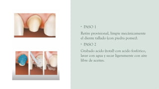 • PASO 1
Retire provisional, limpie mecánicamente
el diente tallado (con piedra pomez).
• PASO 2
Grabado acido (total) con acido fosfórico,
lavar con agua y secar ligeramente con aire
libre de aceites.
 