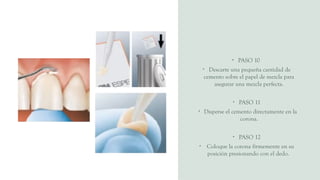 • PASO 10
• Descarte una pequeña cantidad de
cemento sobre el papel de mezcla para
asegurar una mezcla perfecta.
• PASO 11
• Disperse el cemento directamente en la
corona.
• PASO 12
• Coloque la corona firmemente en su
posición presionando con el dedo.
 