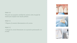 •PASO 10
•Descarte una pequeña cantidad de cemento sobre el papel de
mezcla para asegurar una mezcla perfecta.
•PASO 11
• Disperse el cemento directamente en la corona.
•PASO 12
• Coloque la corona firmemente en su posición presionando con
el dedo.
 