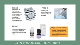 CON IONOMERO DE VIDRIO
 