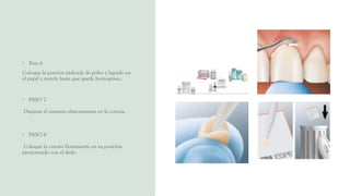 • Paso 6
Coloque la porción indicada de polvo y liquido en
el papel y mezcle hasta que quede homogéneo.
• PASO 7
Disperse el cemento directamente en la corona.
• PASO 8
Coloque la corona firmemente en su posición
presionando con el dedo.
 