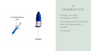 V
GENERACION
• Grabado con acido
ortofosforico al 37%
• Colocamos primer en todas las
áreas de la preparación o
cavidad.
• Fotocurado
 