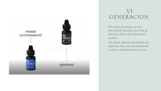 VI
GENERACION
•Se coloca el primer con un
microbrush frotando por toda el
área y se coloca aire para quitar
excesos.
•Se coloca adhesivo frotándolo por
todas las áreas con un microbrush
y coloca aire para retirar excesos.
 